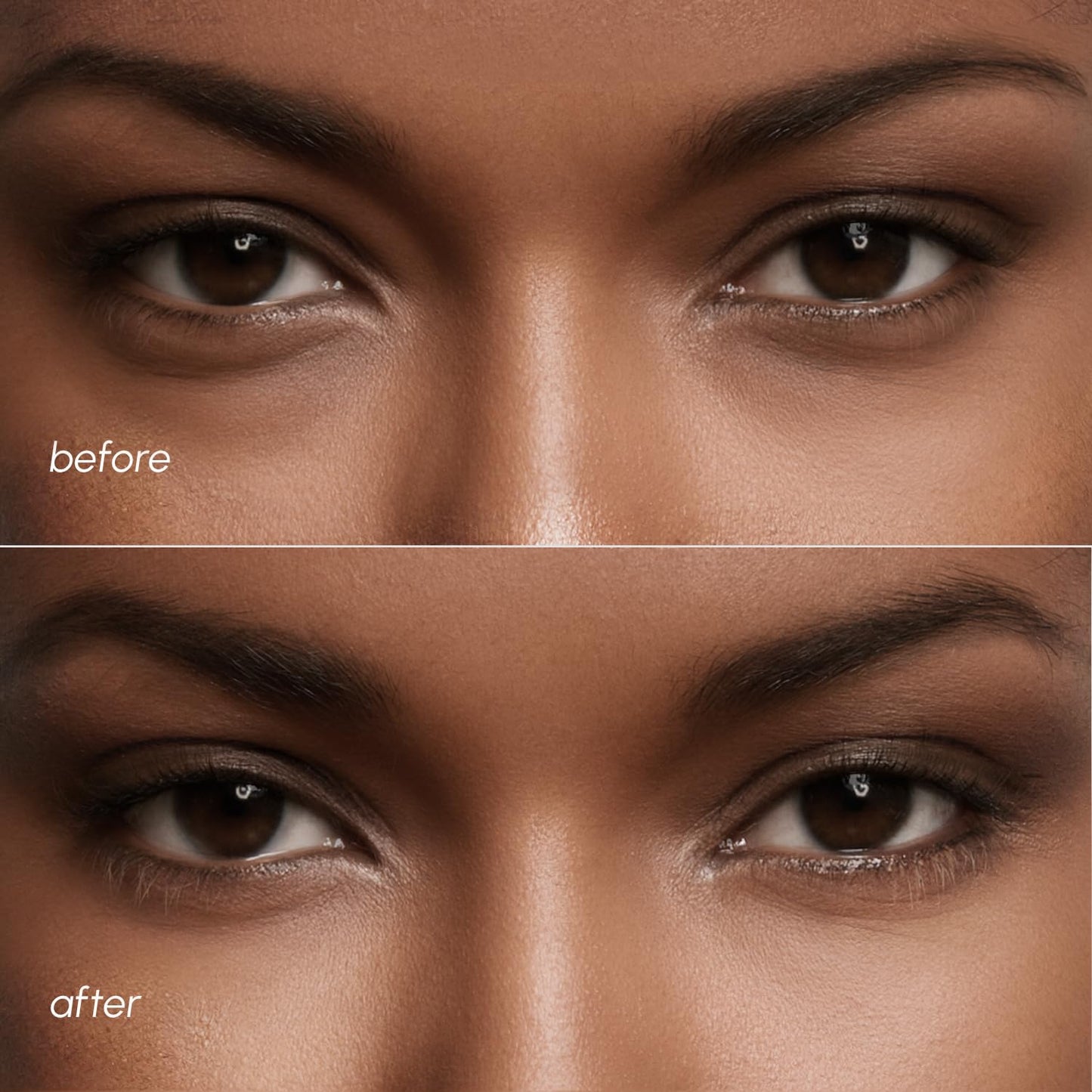 Collagen Under Eye Patches for Women